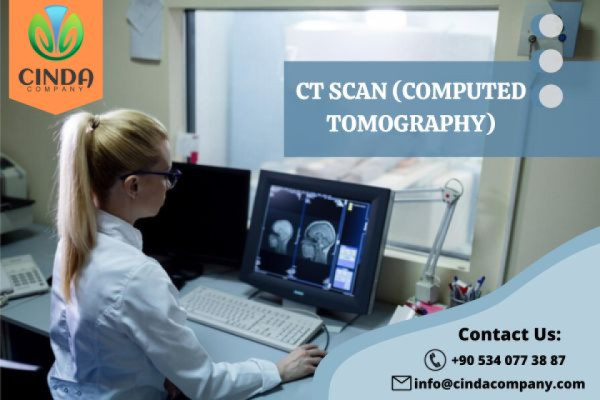 جهاز CT Scan (Computed Tomography)