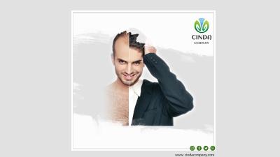 زراعة الشعر بأنواعها